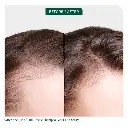 3 FullRescue_PDPresize_BeforeAfter_700x700_JULIA1.webp