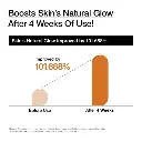 anua-us-moisturizer-150-ml-rice-70-intensive-moisturizing-milk-1161173313.webp